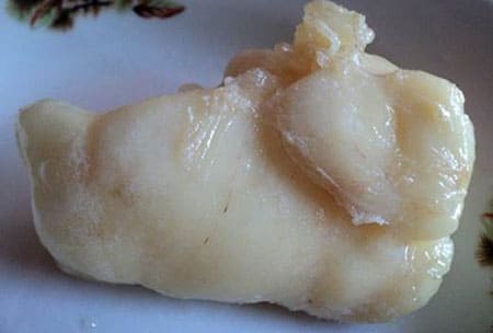 Cholesterolis